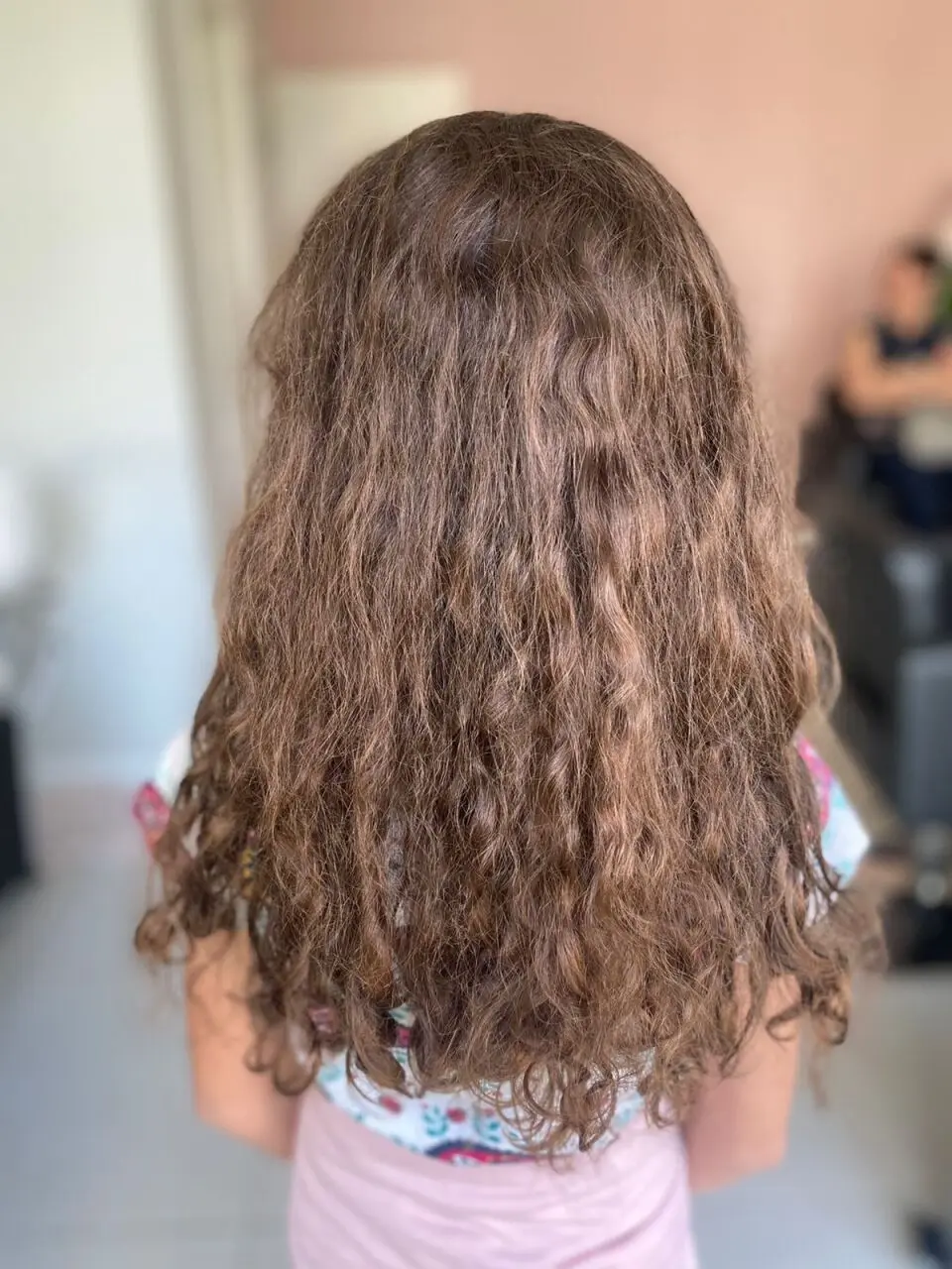 Antes do protocolo Corte 3D + Caracóis Care