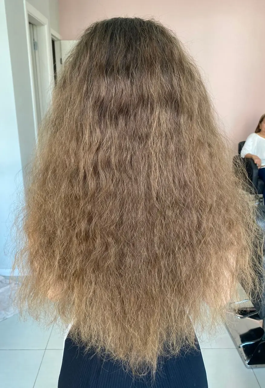 Antes do protocolo Caracóis Care + Acidificação